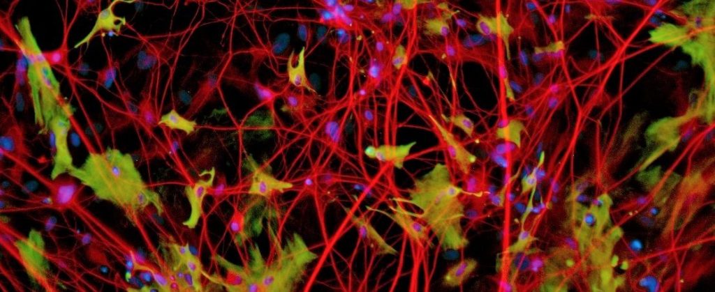 Neurons and glia appear in a 3d culture derived from IPSCs
