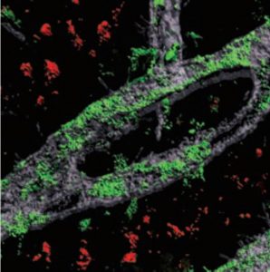 A grayish loop of blood vessel on a black background is covered with green blotches