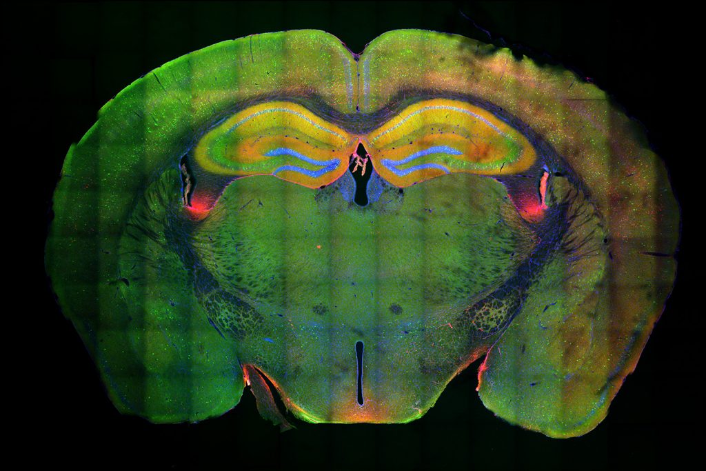 A cross section of a mouse brain stained in a rainbow of colors