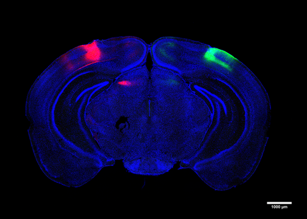 A blue-hued cross-secction of a mouse;s brain highlights the visual cortex in red on the upper left and green on the upperright.