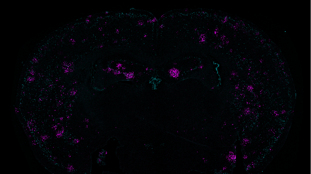 ON a black background the M-shaped coronal cross section of a mouse brain featurse patches of magenta and teal dots