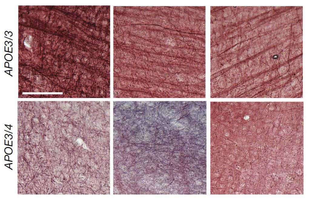 A 3x2 array of squares shows a top row of three pinkish brain tissue samples with clear dark streaks. On the bottom row the pinkish squares of brain tissue don't show such a clear pattern