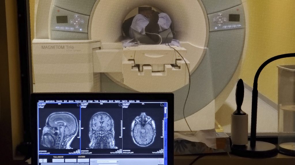 The foreground shows a computer monitor with multiple views inside a brain. The background shows a person lying inside the tube of an MRI machine.