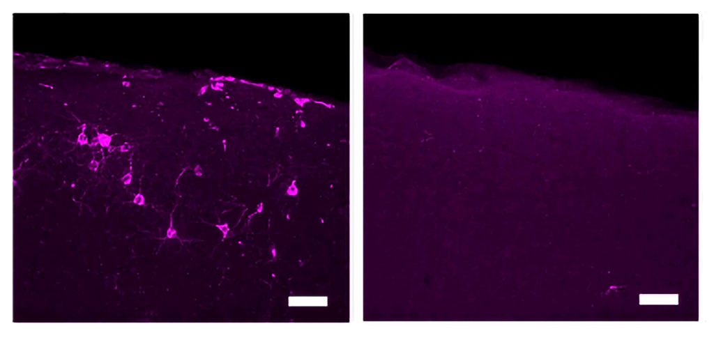 Two panels show sections of mouse brain tissue with a dull magenta glow. In the panel on the left many cells are lit up brightly in magenta. In the panel on the right, only one cell is lit up brightly.