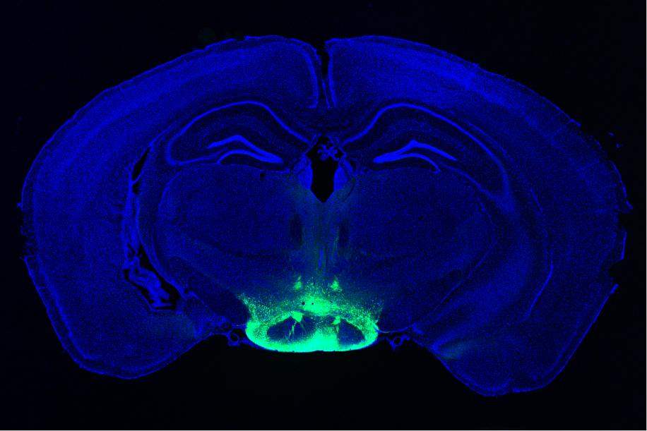 A mouse brain cross section is highlighted n blue. At the bottom center a football-shaped patch is highlighted in green