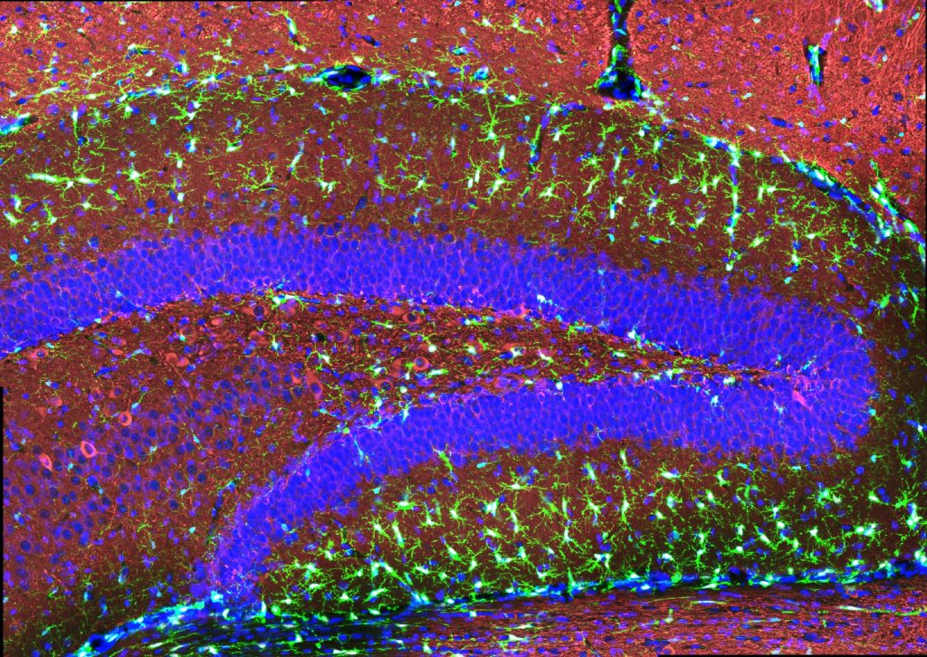 A mouse hippocampus is colorfully stained with the swooping dentate gyrus in blue. Alll around it are little bright green microglia.