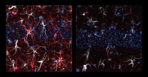 On a black background two panels show spiny microglia cells. In the left panel many are bright red but in the right panel there is very little red coloration